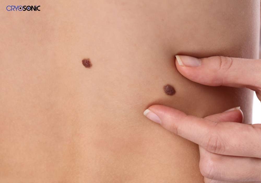 Infection Risk and Poor Aftercare Southall