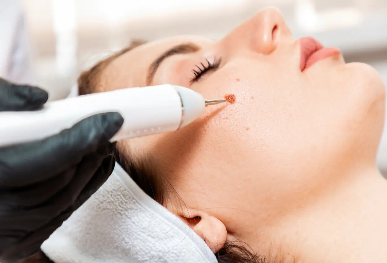 Frequently Asked Questions About Multiple Cryotherapy Treatments Southall