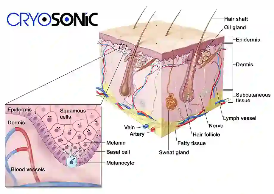 How Cryotherapy Stimulates Melanocyte Activity Southall